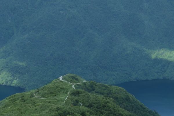 曙光植发医院植发收费一览曙光植发医院植