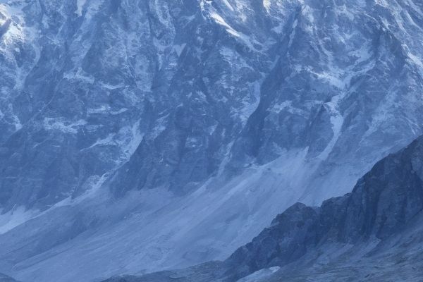 深圳有哪些值得选择的植发医院深圳植发医院哪家靠谱