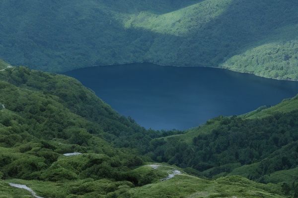 石家庄哪家医院做狐臭手术效果最好石家庄狐臭手术权威机构