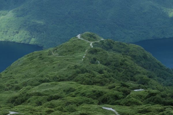 石家庄哪家医院做狐臭手术效果最好石家庄狐臭治疗专业医院