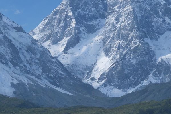 下巴后缩怎么办？正确的矫正方法分享颌面外科治疗