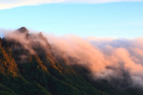 双眼皮手术后10天恢复过程揭秘埋线双眼皮恢复过程展示